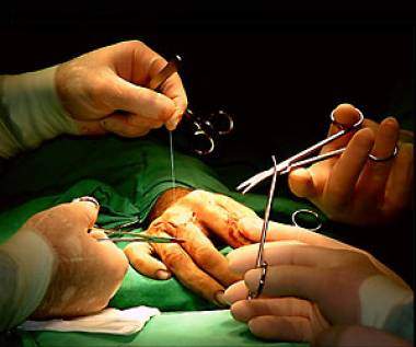 Частные клиники получили право проводить операции по трансплантации органов